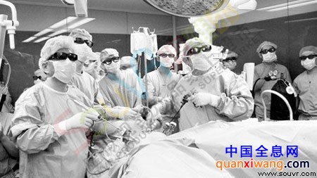 3D高清腹腔镜手术